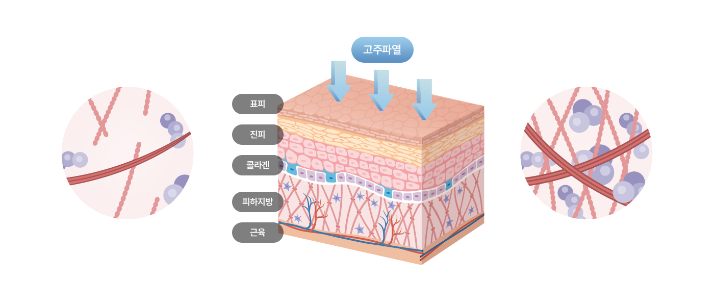 컨텐츠이미지